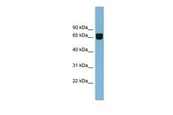 Aviva Systems Biology Corp RIC8B Antibody - middle region (ARP57131_P050)