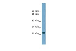 Aviva Systems Biology Corp ARL8B Antibody - middle region (ARP57138_P050)