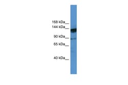 Aviva Systems Biology Corp OGDHL Antibody - N-terminal region (ARP57175_P050)
