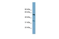 Aviva Systems Biology Corp THNSL2 Antibody - middle region (ARP57188_P050)