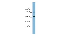 Aviva Systems Biology Corp UEVLD Antibody - middle region (ARP57194_P050)