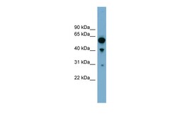 Aviva Systems Biology Corp ARHGAP15 Antibody - middle region (ARP57262_P050)