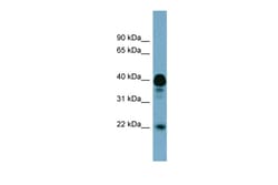 Aviva Systems Biology Corp FAM45BP Antibody - middle region (ARP57263_P050)