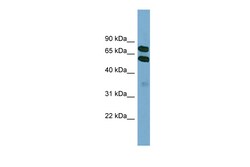 Aviva Systems Biology Corp KLHL9 Antibody - middle region (ARP57295_P050)