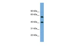 Aviva Systems Biology Corp TERF2IP Antibody - middle region (ARP57302_P050)
