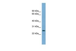 Aviva Systems Biology Corp LIN37 Antibody - middle region (ARP57335_P050)