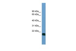 Aviva Systems Biology Corp NT5M Antibody - N-terminal region (ARP57370_P050)