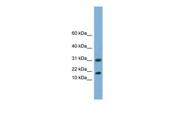 Aviva Systems Biology Corp EIF5A2 Antibody - N-terminal region (ARP57402_P050)