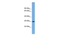 Aviva Systems Biology Corp RAB40C Antibody - N-terminal region (ARP57519_P050)