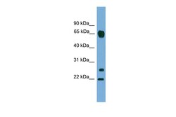 Aviva Systems Biology Corp MMP26 Antibody - C-terminal region (ARP57558_P050)