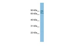 Aviva Systems Biology Corp MTRR Antibody - N-terminal region (ARP57657_P050)