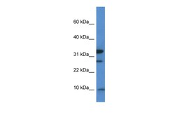 Aviva Systems Biology Corp Mrps33 Antibody - middle region (ARP57707_P050)