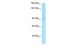 Aviva Systems Biology Corp OPA1 Antibody - N-terminal region (ARP57715_P050)