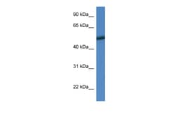 Aviva Systems Biology Corp Mapk10 Antibody - N-terminal region (ARP57728_P050)