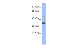 Aviva Systems Biology Corp PYCR1 Antibody - middle region (ARP57751_P050)