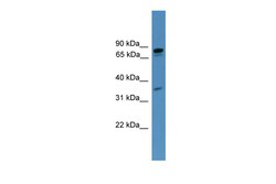 Aviva Systems Biology Corp PDE8A Antibody - C-terminal region (ARP57753_P050)