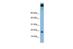 Aviva Systems Biology Corp ASAH1 Antibody - middle region (ARP57761_P050)