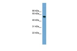Aviva Systems Biology Corp PKM2 Antibody - middle region (ARP57789_P050)