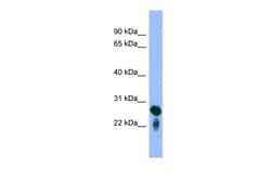 Aviva Systems Biology Corp RAB5C Antibody - middle region (ARP57818_P050)