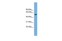 Aviva Systems Biology Corp FOXN3 Antibody - middle region (ARP57855_P050)