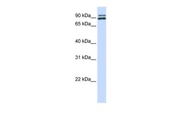 Aviva Systems Biology Corp PCSK6 Antibody - N-terminal region (ARP57880_P050)