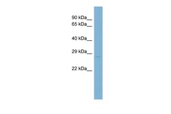 Aviva Systems Biology Corp SSX1 Antibody - middle region (ARP57900_P050)