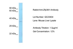 Aviva Systems Biology Corp Zfp36l1 Antibody - C-terminal region (ARP57901_P050)
