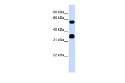 Aviva Systems Biology Corp CEBPA Antibody - middle region (ARP57937_P050)