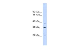 Aviva Systems Biology Corp CEBPA Antibody - C-terminal region (ARP57938_P050)