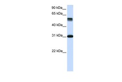 Aviva Systems Biology Corp TRIM31 Antibody - middle region (ARP57948_P050)