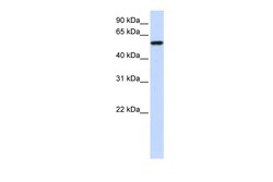 Aviva Systems Biology Corp ZNF675 Antibody - N-terminal region (ARP57962_P050)