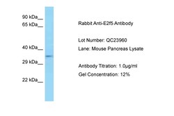 Aviva Systems Biology Corp E2f5 Antibody - C-terminal region (ARP57966_P050)