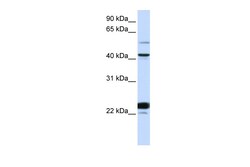 Aviva Systems Biology Corp EVX1 Antibody - N-terminal region (ARP57971_P050)