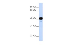 Aviva Systems Biology Corp FOXL1 Antibody - middle region (ARP57981_P050)