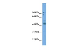 Aviva Systems Biology Corp HOXB3 Antibody - middle region (ARP58019_P050)