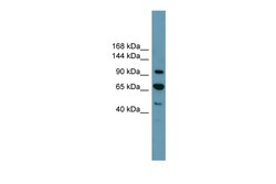 Aviva Systems Biology Corp RB1 Antibody - middle region (ARP58066_P050)