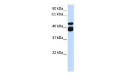 Aviva Systems Biology Corp TBX6 Antibody - middle region (ARP58088_P050)
