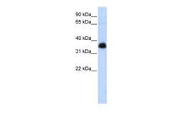 Aviva Systems Biology Corp AIP Antibody - N-terminal region (ARP58132_P050)
