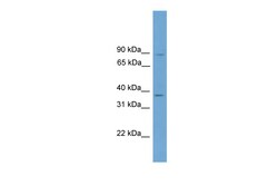 Aviva Systems Biology Corp GTF2A1 Antibody - middle region (ARP58156_P050)
