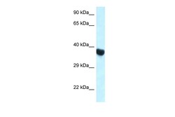Aviva Systems Biology Corp Hoxa10 Antibody - C-terminal region (ARP58160_P050)