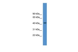 Aviva Systems Biology Corp PSMC3 Antibody - N-terminal region (ARP58176_P050)