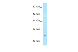 Aviva Systems Biology Corp PHLDA2 Antibody - N-terminal region (ARP58238_P050)