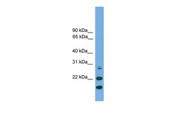 Aviva Systems Biology Corp ASF1A Antibody - N-terminal region (ARP58260_P050)