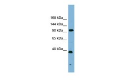 Aviva Systems Biology Corp ERCC4 Antibody - middle region (ARP58272_P050)