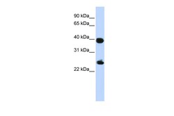 Aviva Systems Biology Corp H2AFY Antibody - middle region (ARP58283_P050)