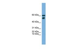 Aviva Systems Biology Corp ZNF765 Antibody - N-terminal region (ARP58368_P050)