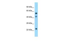 Aviva Systems Biology Corp Igf2bp1 Antibody - N-terminal region (ARP58385_P050)