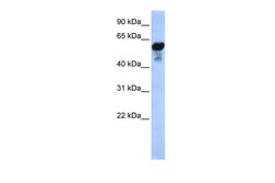 Aviva Systems Biology Corp ALDH1B1 Antibody - middle region (ARP58417_P050)