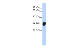 Aviva Systems Biology Corp CA1 Antibody - N-terminal region (ARP58432_P050)