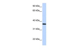 Aviva Systems Biology Corp LCN12 Antibody - N-terminal region (ARP58489_P050)